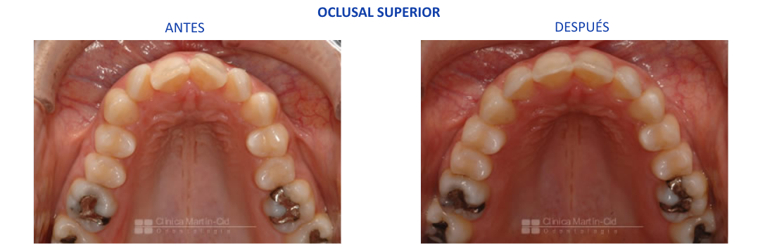 caso2 ortodoncia