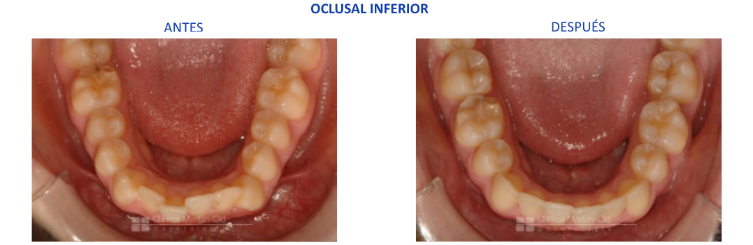 caso4 ortodoncia