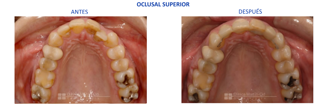 caso7 ortodoncia