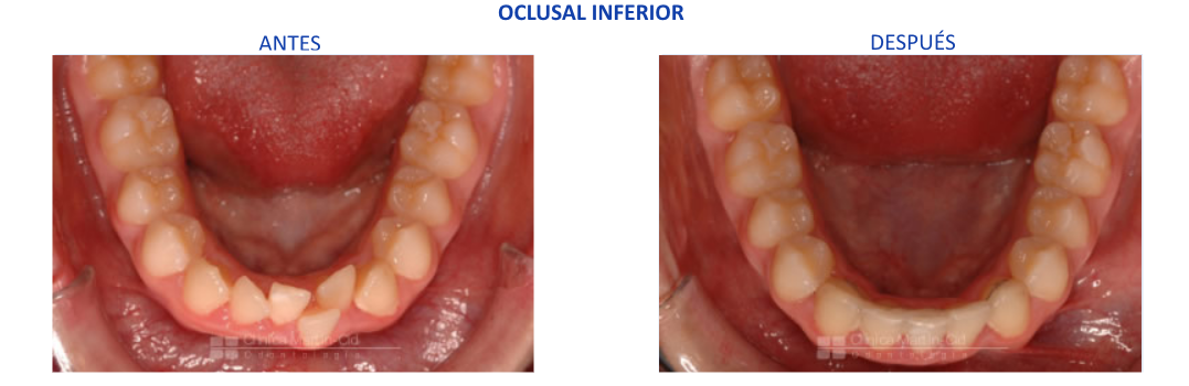 caso9 ortodoncia