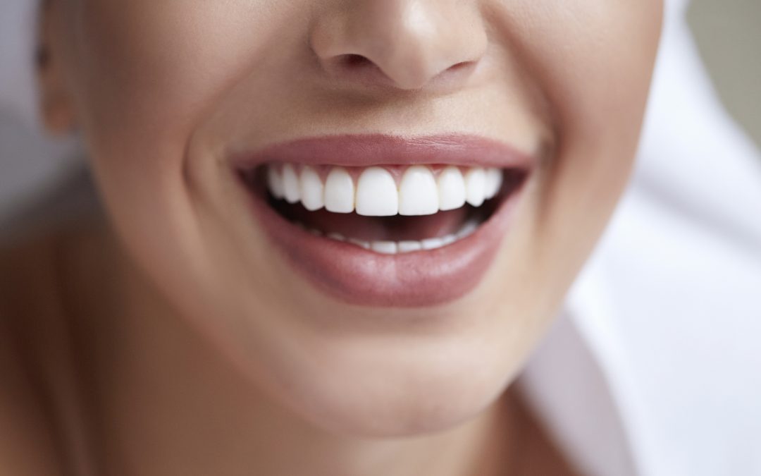 Todo lo que debes saber sobre el blanqueamiento dental