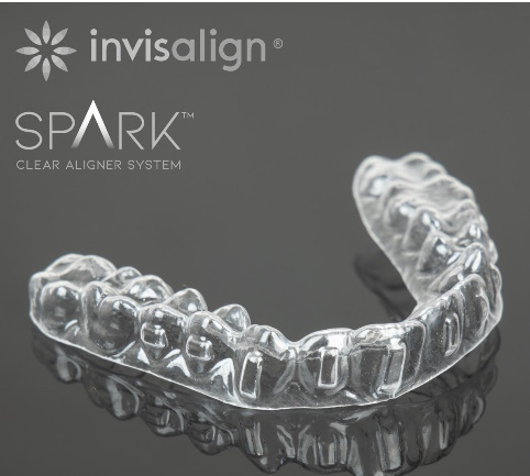 invisalign