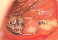 odontologia infantil alcala de henares